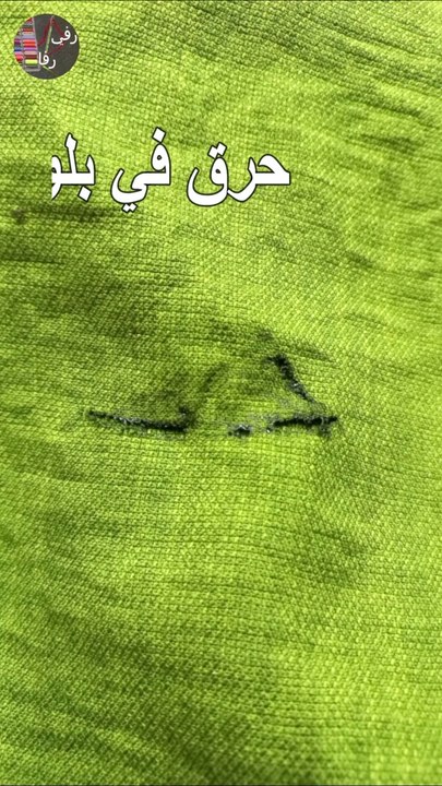 See, fabric burns have become very easy to repair.
