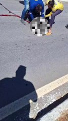 Mulher perde metade da perna após acidente com caçamba