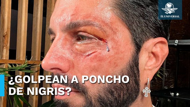 Poncho de Nigris aparece golpeado y sorprende a usuarios en redes