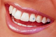 Cirurgião dentista, Felipe Vieira explica se o uso de piercing no dente pode afetar a saúde bucal