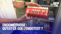 Qu'est-ce que l'Endotest, ce test salivaire pour mieux diagnostiquer l'endométriose?
