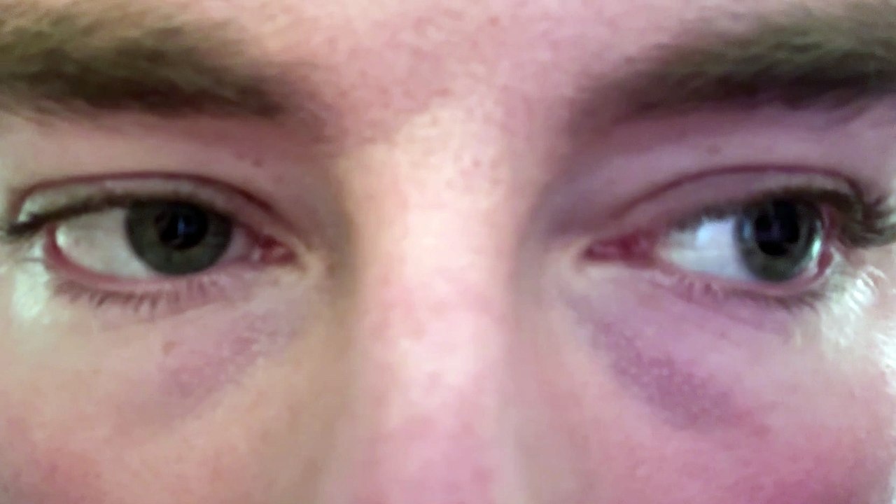 Eyes_Blinking