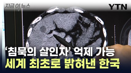'침묵의 살인자' 지방간 예방에 새 희망...국내 연구진, 첫 규명 [지금이뉴스] / YTN