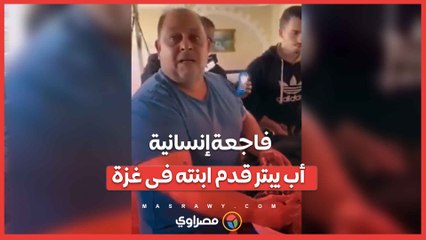 فاجعة إنسانية- طبيب يجبر على بتر قدم ابنته دون مخدر في شمال غزة
