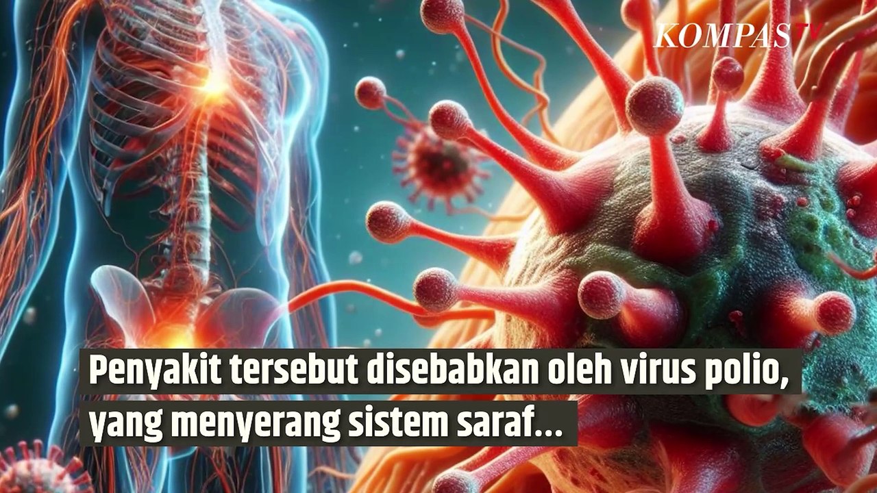 Berapa Lama Polio Bisa Menular ke Orang Lain? Ini Penjelasannya| SINAU