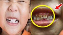 Bacche Ka Dant Kitkitana, Vajah Kya Hai | Kids Teeth Grinding Reason | Baby Bruxism Reason| Boldsky