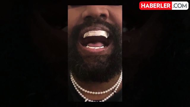 Kanye West, 850.000 dolarlık titanyum protez dişler taktırdı