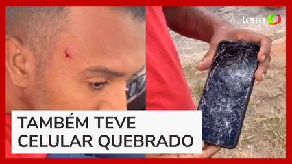 Motorista de app denuncia que foi mordido por passageira por não ligar ar-condicionado na Bahia