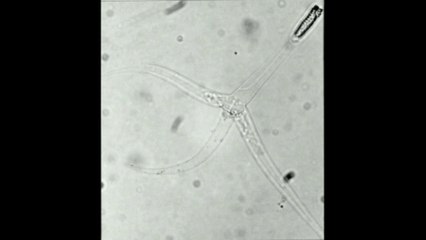 ¿Cuál es el animal más pequeño del mundo? Aquí te lo respondo