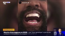 Kanye West dévoile ses nouvelles dents en titane à 780.000 euros