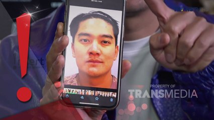 Blak-blakan Boy William Nekad Jalani Operasi Hidung