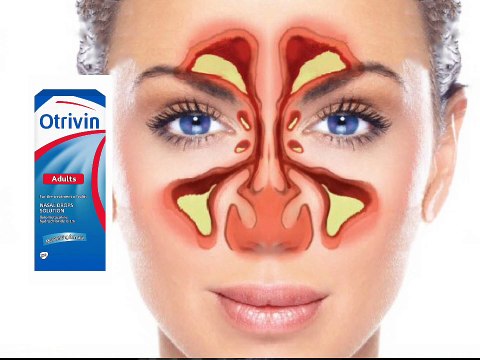 التهابات الجيوب الأنفية ونقط اوتروفين