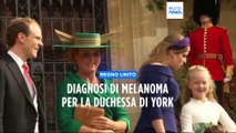 Regno Unito: diagnosi di melanoma per la duchessa di York Sarah Ferguson