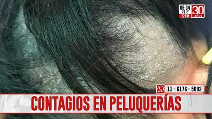Peluquerías en la mira por proliferación de hongos