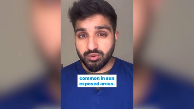 What is malignant melanoma and the symptoms of skin cancer?