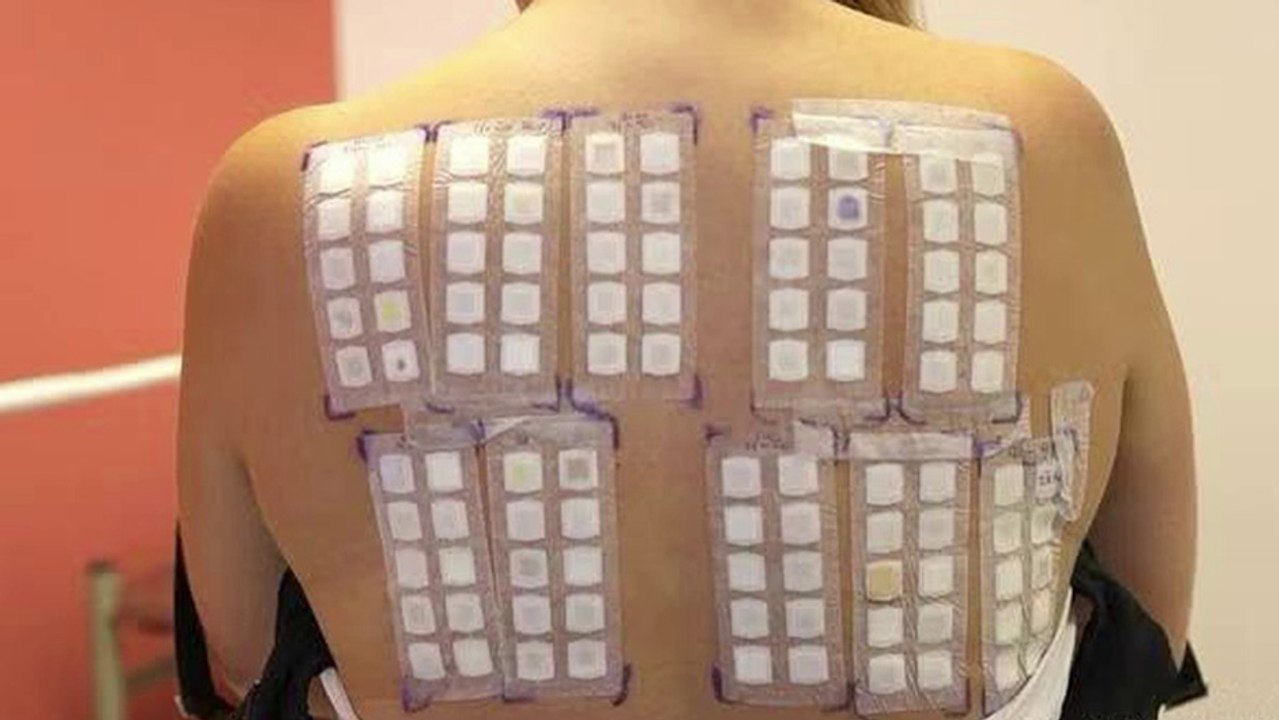 bd-que-es-la-urticaria-y-como-se-trata-220124