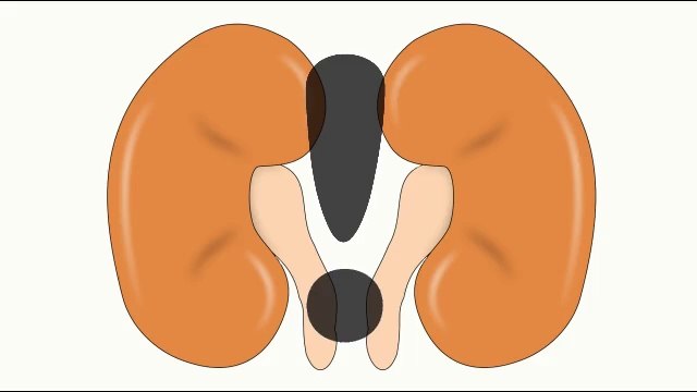 Rins - Livre-se das dores nos rins com esses cuidados naturais.