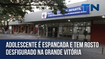 Adolescente é espancada e tem rosto desfigurado na Grande Vitória