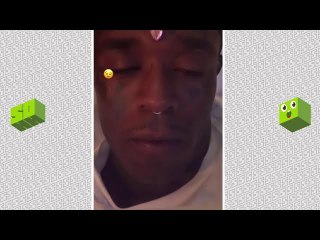 Lil Uzi Vert Explains His Massive Forehead Diamond Implant