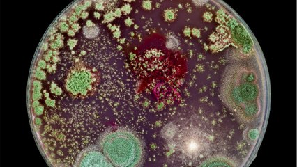 Neue Bakterienart: Ärzte machen Entdeckung mithilfe neuer Technologie