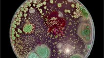 Doctors discover new type of bacteria in London hospital