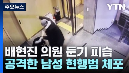 배현진 의원, 10대 괴한에 둔기 피습..."두피 열상 1차 봉합" / YTN