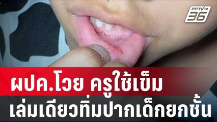 ผปค.โวย ครูใช้เข็มเล่มเดียวทิ่มปากเด็กยกชั้น | โชว์ข่าวเช้านี้ | 26 ม.ค. 67