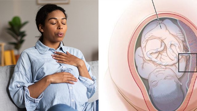 Amniotic Fluid Embolism Symptoms In Hindi | Amniotic Fluid Embolism Risk Factors | Boldsky