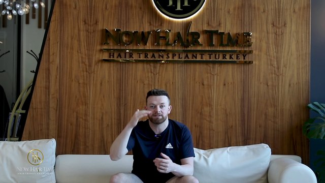 Final result of the hair transplant after 8 Months!