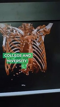 College and University Insurance Protecting Educational Institutions