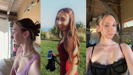 Woman bullied for looking like a "squirrel" underwent $200k surgery to replace her jaw