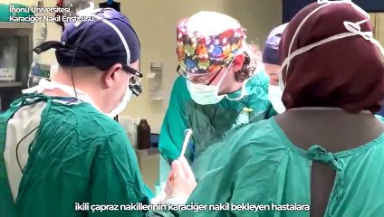 Dünyanın ilk 6’lı çapraz karaciğer nakli Türkiye'de gerçekleşti