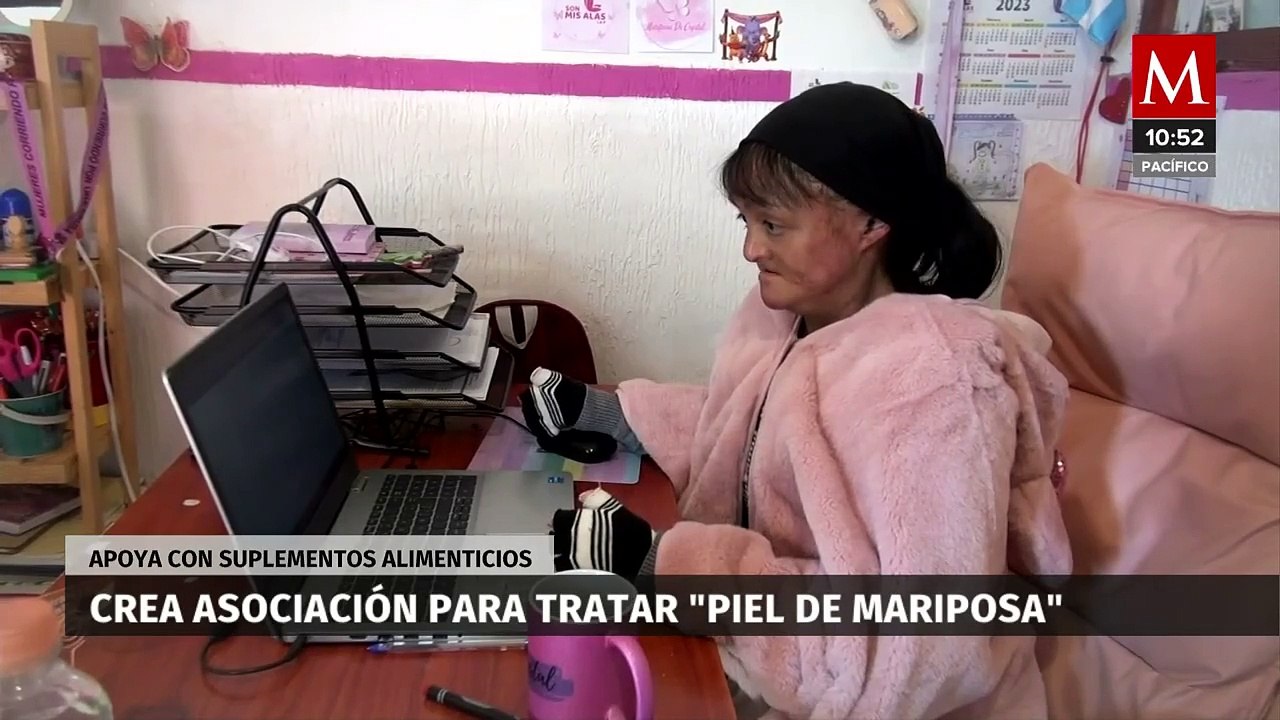 Sonia Ortiz, fundadora de 'Son Mis Alas', la asociación que ayuda a niños con 'piel de mariposa'