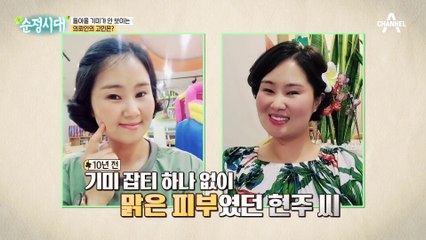 일상을 망친 주범! 왜 의뢰인의 피부에 기미가 생겼을까?