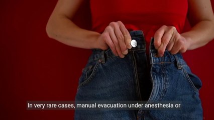 "Natural Remedies Unleashed: 15 Effective Strategies to Overcome Constipation"