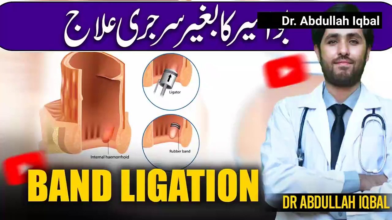 Get Rid Of Piles Without Surgery in 24 hours _ Band Ligation _ Bawseer Ka Fori I video Dailymotion