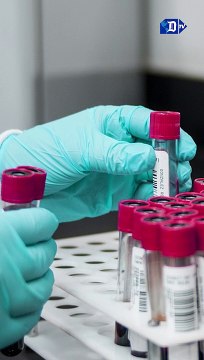 Desarrollan un análisis de sangre que puede detectar el Alzheimer con una precisión de hasta el 95% | La buena noticia