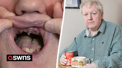 Ex-miner, 62, on diet of soup and painkillers as he can't afford £5,400 dentist bill