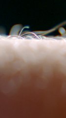 ECTLS - Pourquoi nos poils se hérissent-ils quand on a froid ?