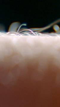 ECTLS - Pourquoi nos poils se hérissent-ils quand on a froid ?