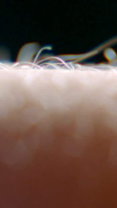 ECTLS - Pourquoi nos poils se hérissent-ils quand on a froid ?