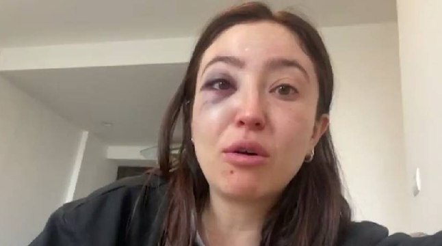 Mujer colombiana fue agredida físicamente por su pareja en México