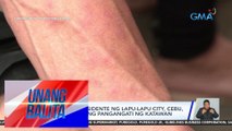 Mahigit 100 residente ng Lapu-Lapu City, Cebu, nakararanas ng pangangati ng katawan | UB