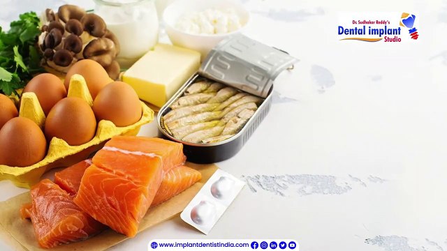 Vitamin D and Dental Implants_ Role of Vitamin D in Dental Implant Success and Overall Dental Health_ Dental Implant Studio, Bangalore.