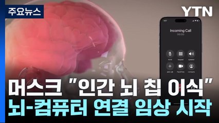 머스크 "인간 뇌에 칩 이식"...뇌-컴퓨터 연결 임상 시작 / YTN