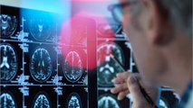 Alzheimer-Studie: Mögliche Übertragbarkeit durch medizinische Behandlungen