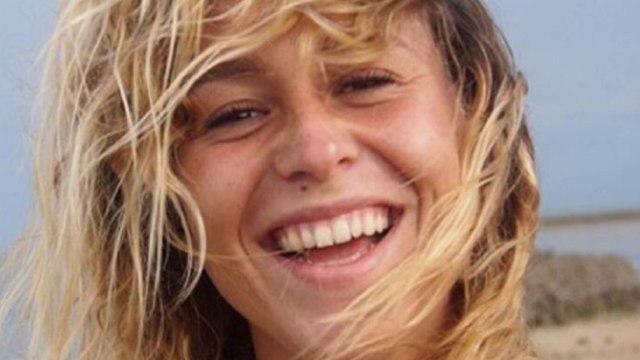 GALA VIDEO - Candice (Koh-Lanta) : l’aventurière opérée du visage dévoile des clichés impressionnants