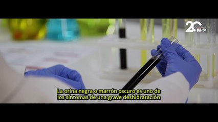 ¿Por qué en la película ‘La Sociedad de la Nieve’, la orina de los sobrevivientes era negra?
