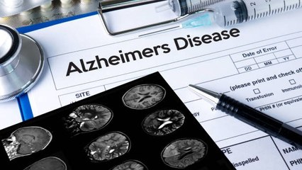 El Alzheimer "Puede Contagiarse", Según Un Nuevo Descubrimiento