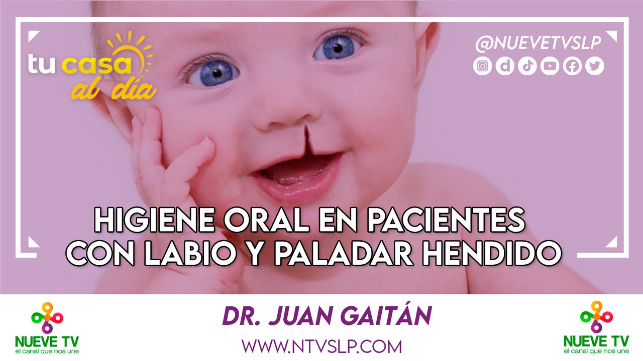 Higiene Oral en Pacientes con Labio y Paladar Hendido